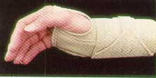 Ambidextrous Cock Up Wrist Splint-MMCOR220-mse