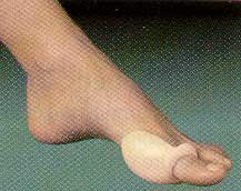 Silopad Gel Bunion - Small-MMSIL104-mse