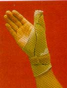 Thumb Spica-MMUPI124-mse