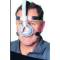 2 Nasal Mask for CPAP and Bi-level Ventilation