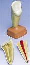 2 Part Upper Incisor Anatomy Model