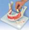 21 Part Dental Disease Anatomy Model