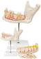 6 Part Half Lower Jaw Anatomy Model