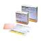 Allevyn Adhesive Hydrocellular Dressing