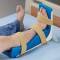 Replacement Foam Liner For Foot-Drop Splint