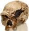 Steinheim Anthropological Skull