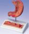 Stomach Anatomy Model with Ulcers