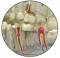 Image Showing Dental Pathologies