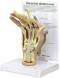 Rheumatoidarthritis Hand Model