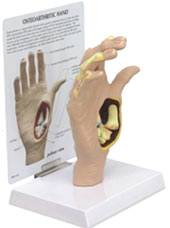 Osteoarthritis Hand Model