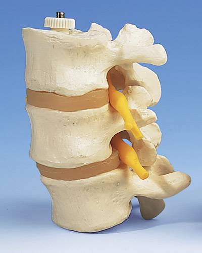 3 Lumbar Vertebrae, Flexibly Mounted