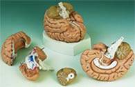 Medical Divided Brain