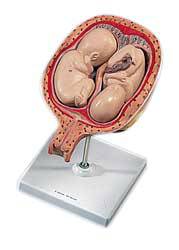 5th Month Twin Fetuses, Normal Position 