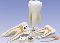 Giant Molar Anatomy Models