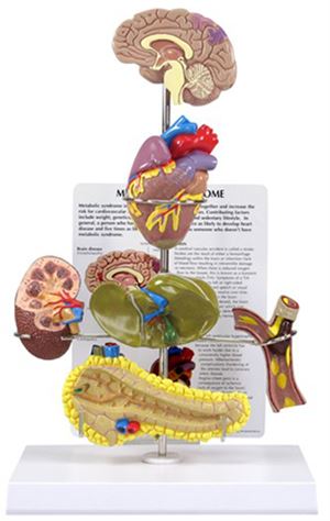 Metabolic Syndrome