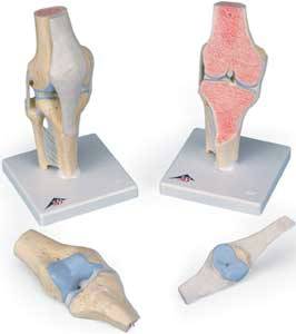 Anatomical 3 Part Sectional Knee Joint M