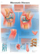 Rheumatic Diseases Chart