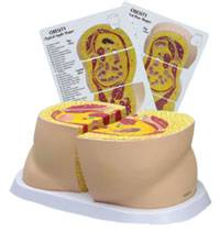 Anatomical Obesity Model