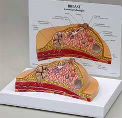 Breast Model w/ Pathologies