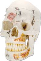 Demonstration Skull