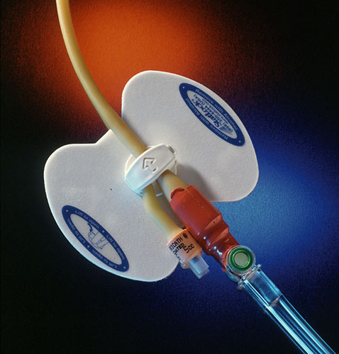 Foley Catheter Securement Device