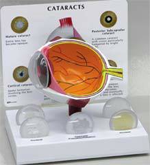 Human Eye Model Cross- Section