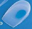 Latteral Silicone Heel Supports