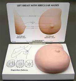 Left Breast Model w/ Irregular Masses