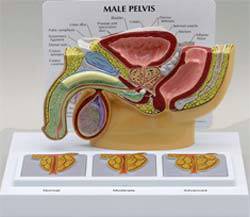 Male Pelvis Cross Section w/ Enlarged Prostates