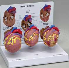 Mini Heart Model Set