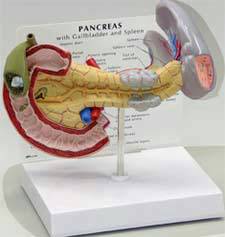 Pancreas Cancer Model