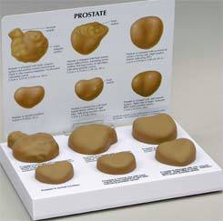 Prostate Model Set