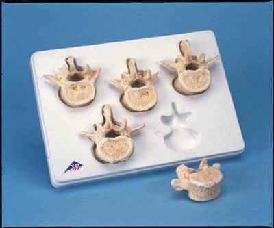 Lumbar Vertebrae Model