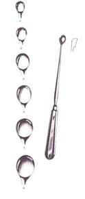 Simon Cup Curette