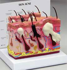 Skin Model Normal  Acne