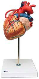 Heart Bypass Model