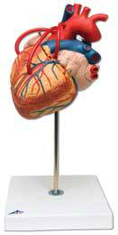 Standard 4 Part Heart w/ Bypass Model