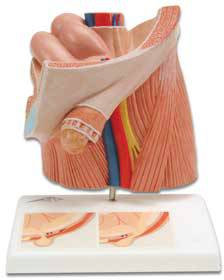 Standard Anatomical Inguinal Hernia Model