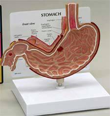 Stomach Model w/ Ulcers