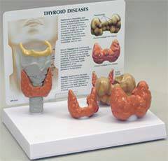 Thyroid & Larynx Model Set