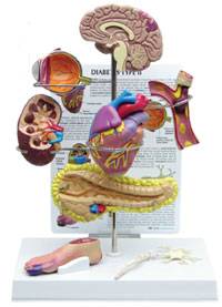 Type II Diabetes Model Set