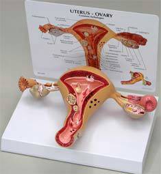 Ovary & Uterus Model w/ Pathologies