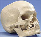 Young Male Microcephalic Skull